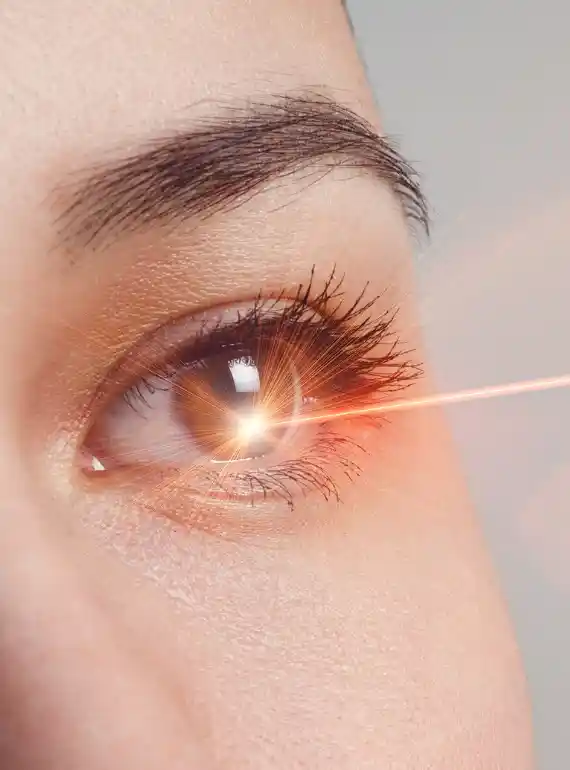 lasik cirugia Cirugía LASIK en Guadalajara