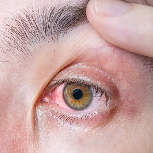 especialista en problemas vasculares del ojo